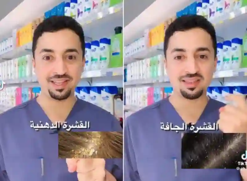 صيدلي يكشف عن أنواع شامبو في السعودية سعرها رخيص وتقضي على القشرة 